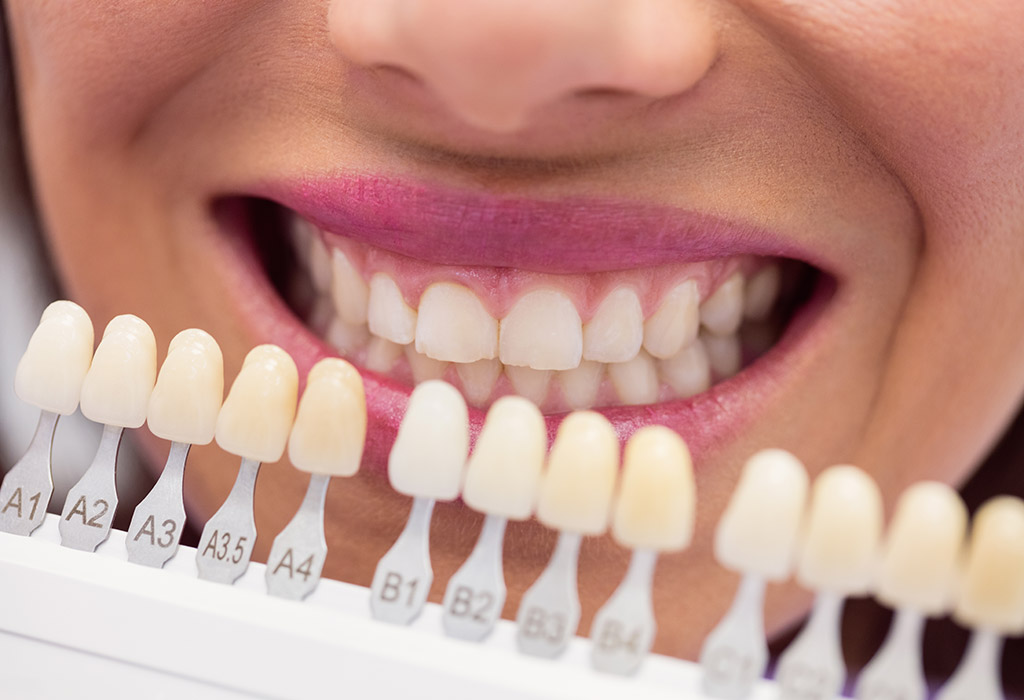 Estética dental en Mollet del Vallès 