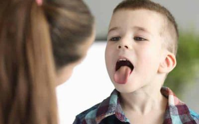Aftas bucales: Cómo prevenirlas y tratarlas eficazmente